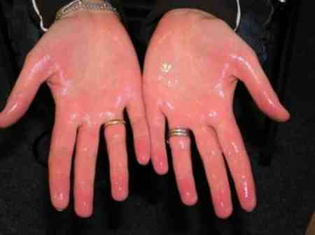 دلیل سردی پا چیست