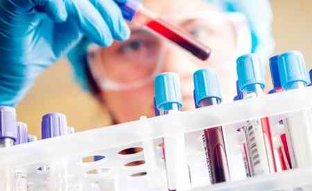 چه گروه خونی میتوانند باهم ازدواج کنند (2)