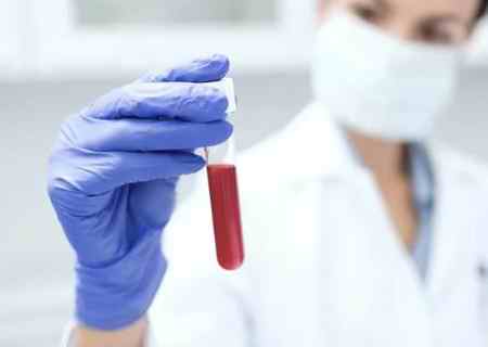 چه گروه خونی میتوانند باهم ازدواج کنند (3)