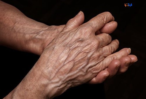 علت برآمدگی رگ ها