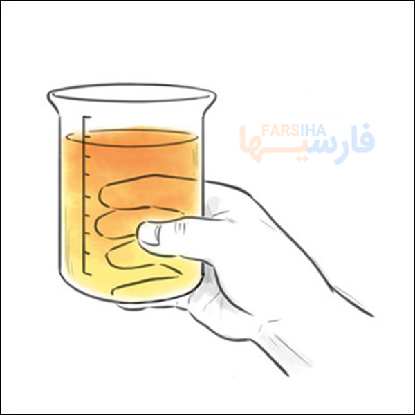 علت دیده شدن خون در ادرار چیست؟