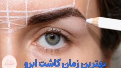 کاشت ابرو