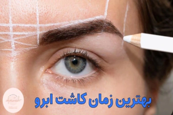 کاشت ابرو