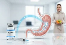 بوتاکس لاغری